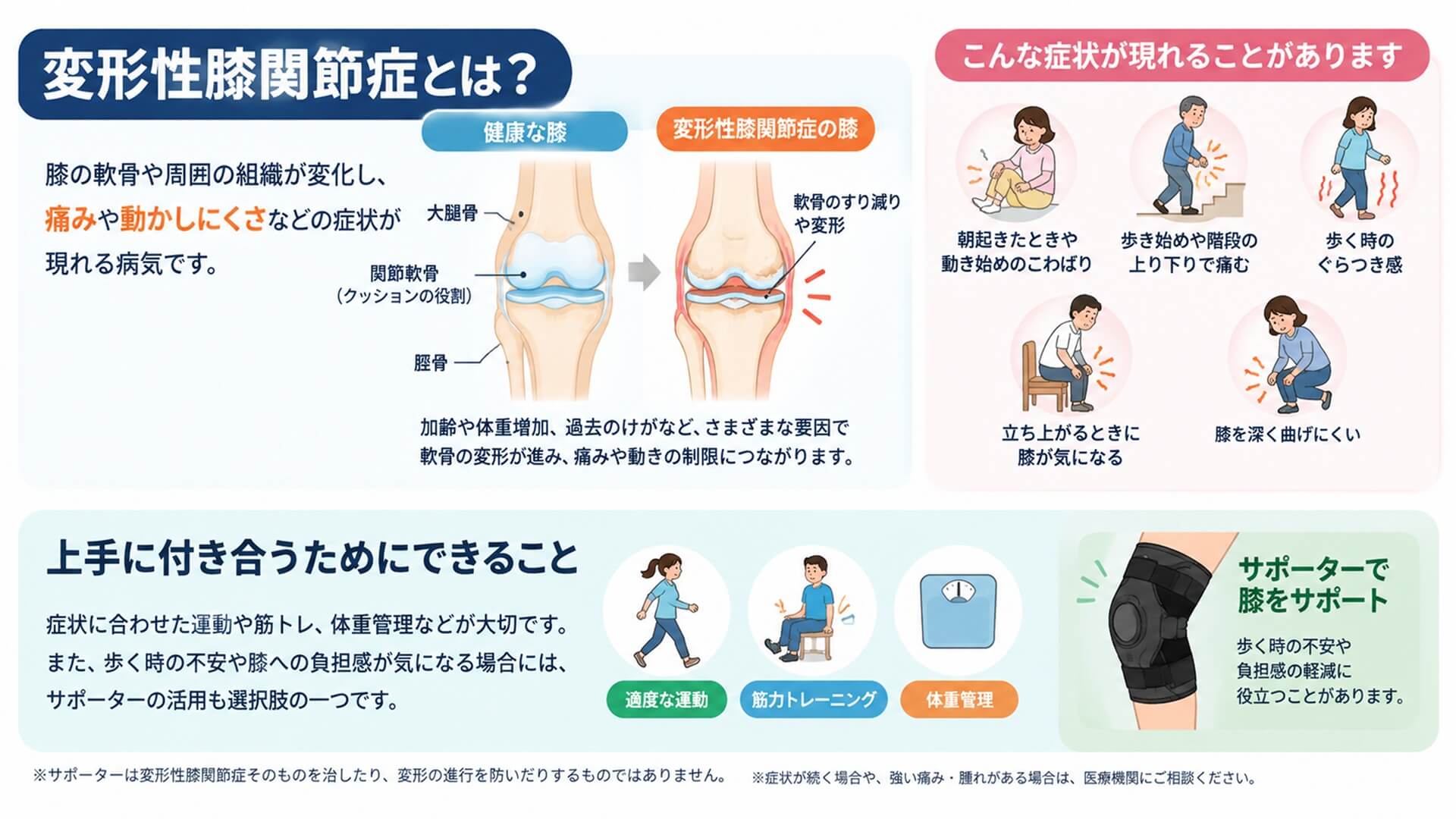 変形性膝関節症とは?図解説明